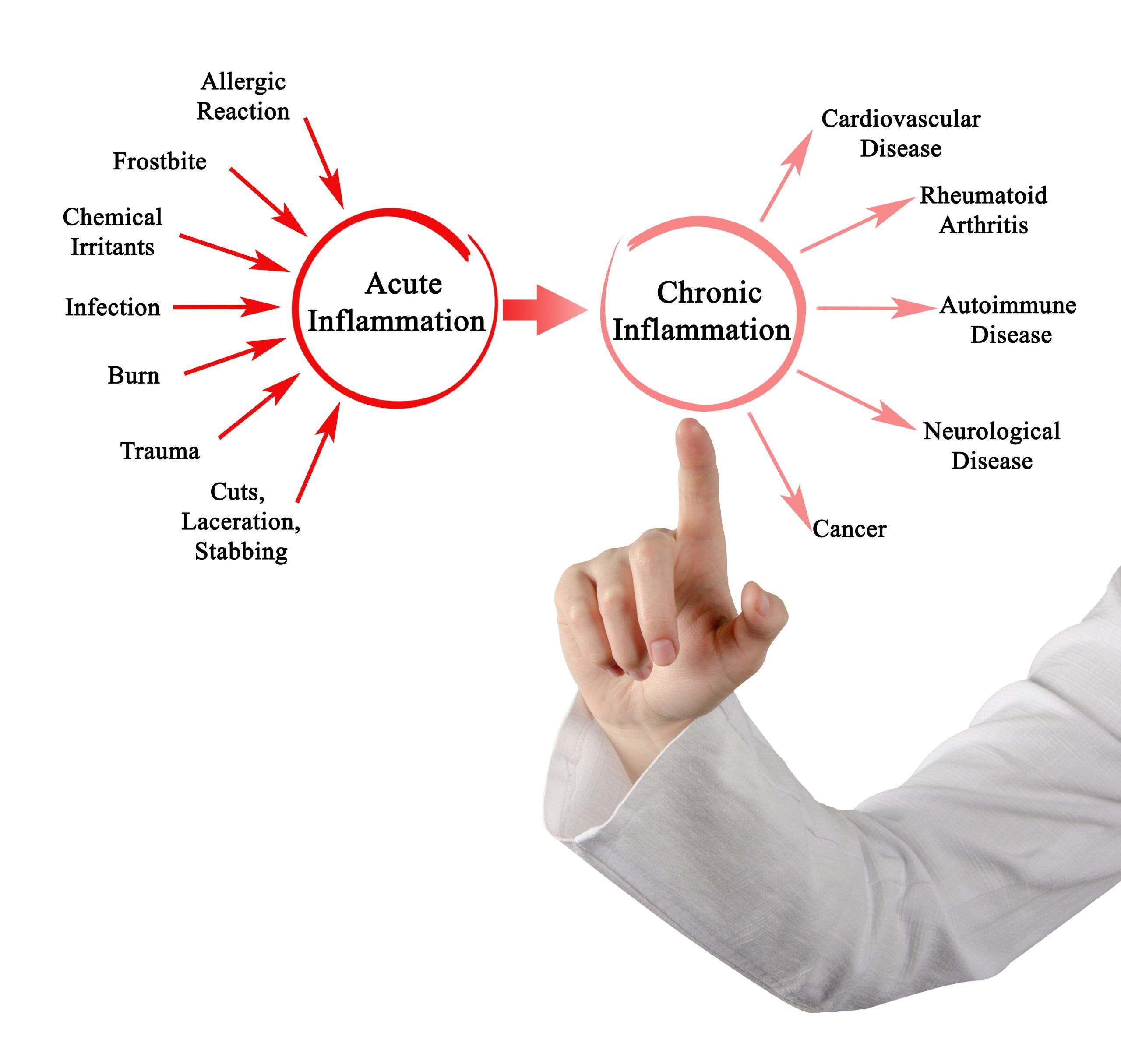 Got Inflammation? See Your Chiropractor